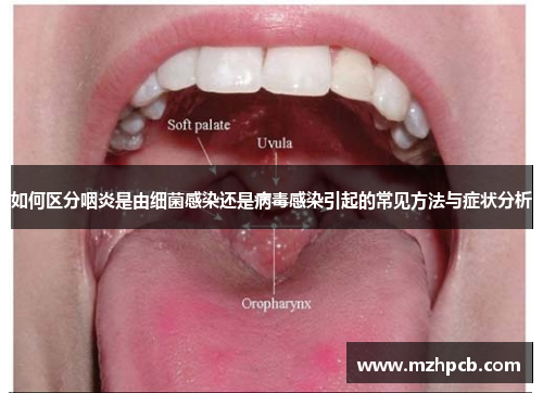如何区分咽炎是由细菌感染还是病毒感染引起的常见方法与症状分析